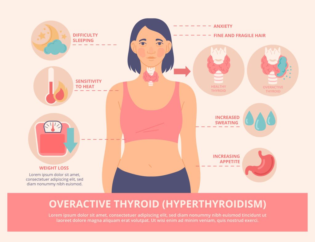 thyroid